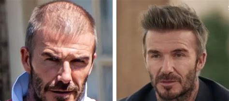 Famous Men Who Have (Apparently) Had Successful Hair .